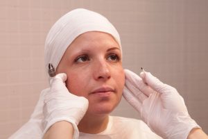 tratamiento de micropigmentación de cejas